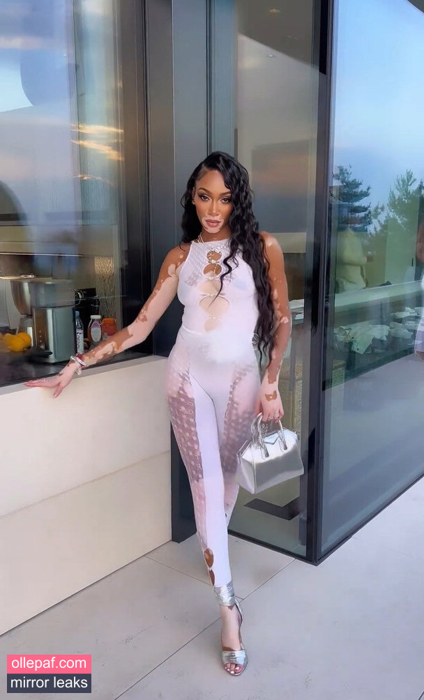 Latest Leaks Winnie Harlow Nude #367 - Fapello