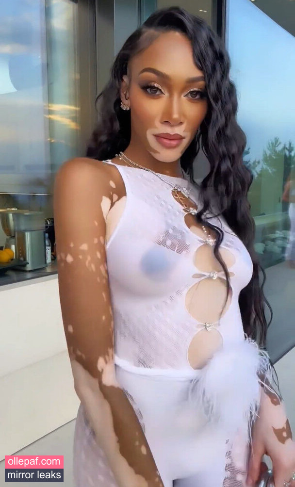 Latest Leaks Winnie Harlow Nude #369 - Fapello