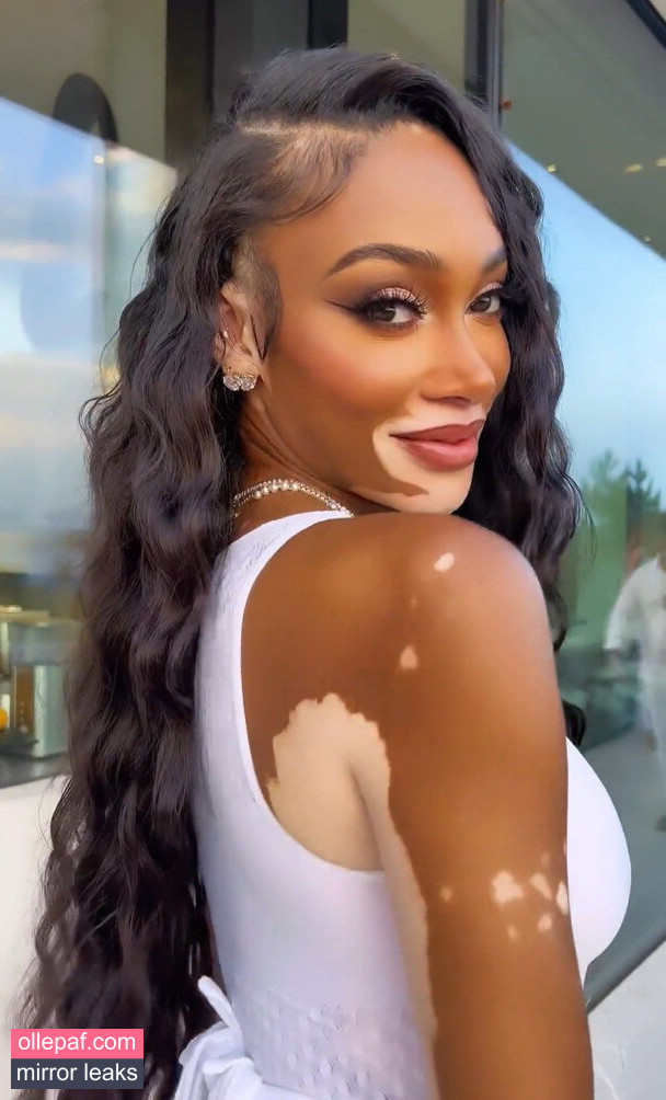 Latest Leaks Winnie Harlow Nude #370 - Fapello