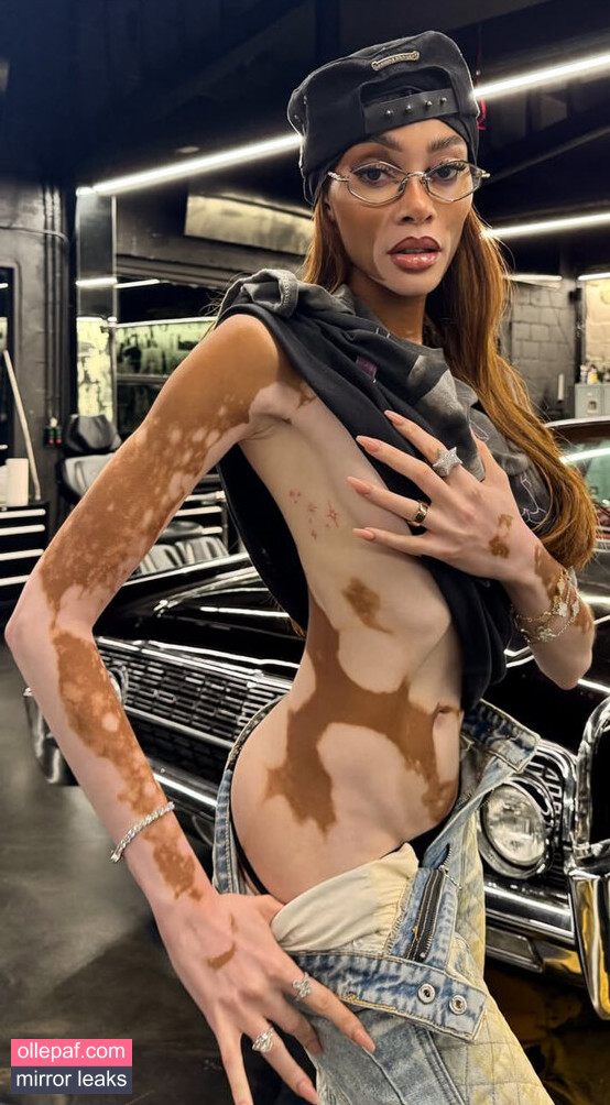 Latest Leaks Winnie Harlow Nude #38 - Fapello
