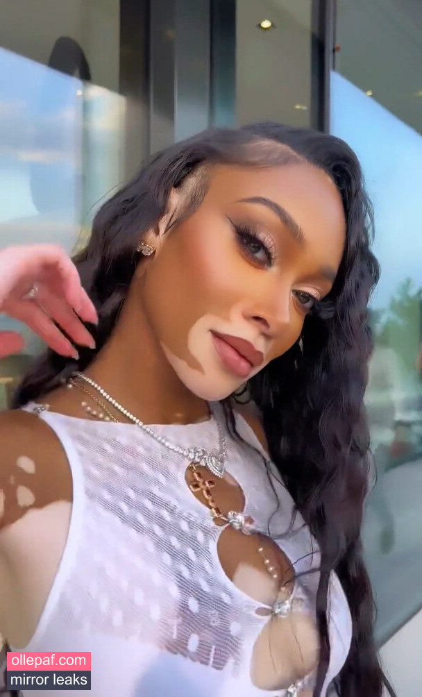 Latest Leaks Winnie Harlow Nude #371 - Fapello