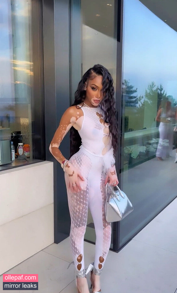 Latest Leaks Winnie Harlow Nude #373 - Fapello