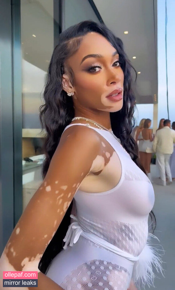 Latest Leaks Winnie Harlow Nude #375 - Fapello