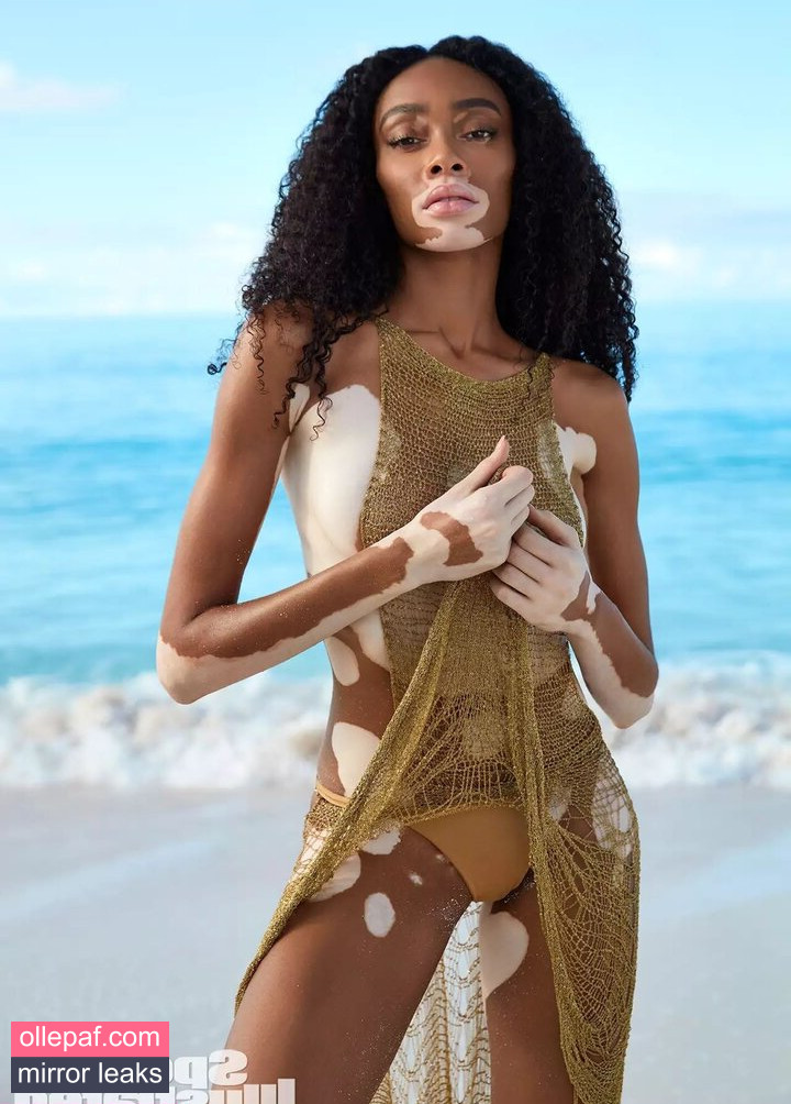 Latest Leaks Winnie Harlow Nude #379 - Fapello
