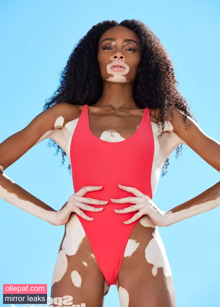 Latest Leaks Winnie Harlow Nude #383 - Fapello