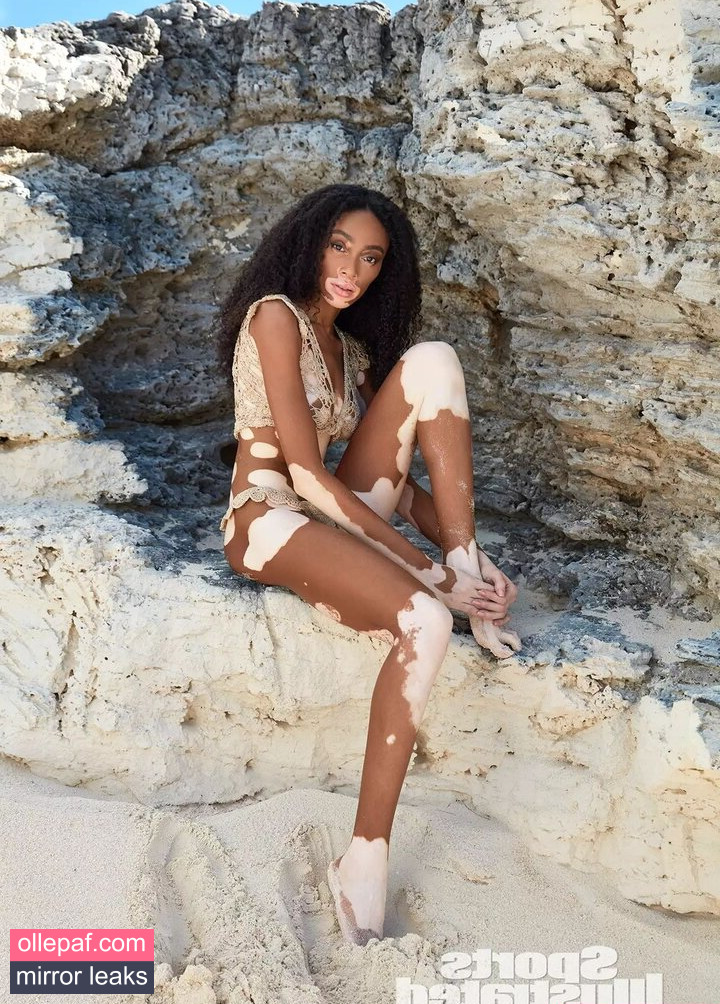 Latest Leaks Winnie Harlow Nude #384 - Fapello