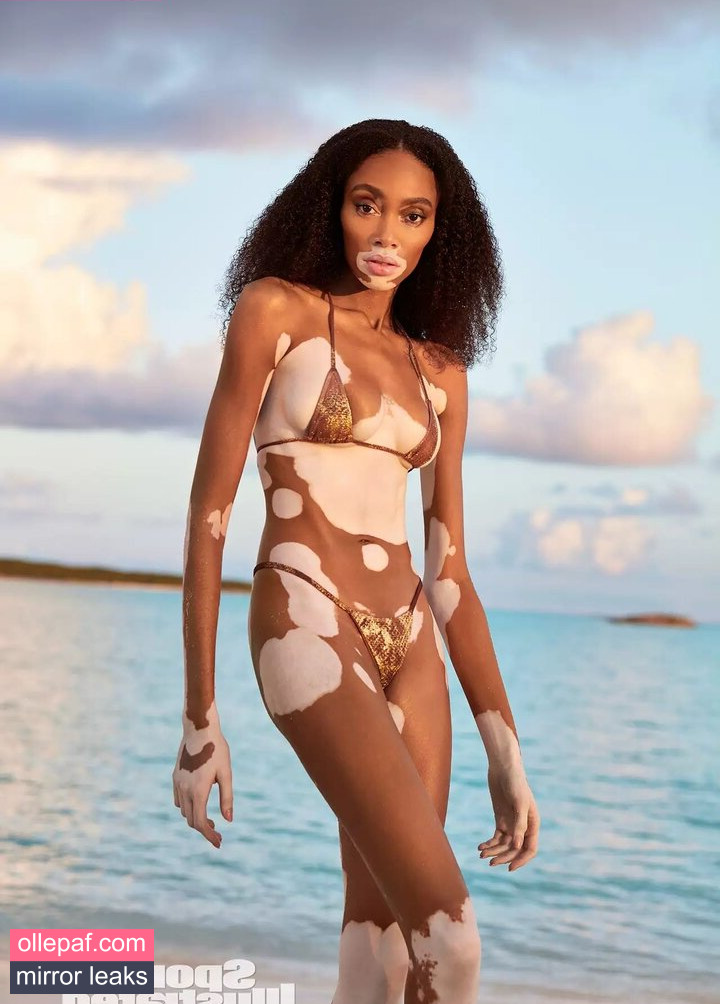 Latest Leaks Winnie Harlow Nude #388 - Fapello