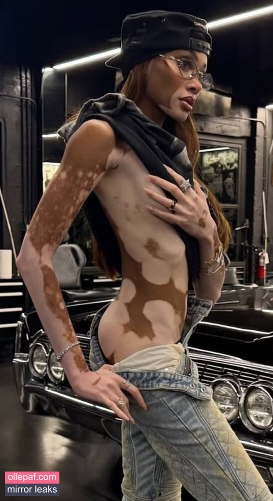 Latest Leaks Winnie Harlow Nude #40 - Fapello