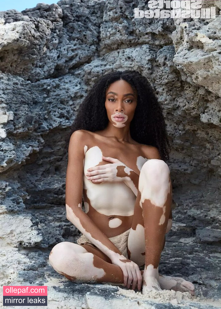 Latest Leaks Winnie Harlow Nude #395 - Fapello