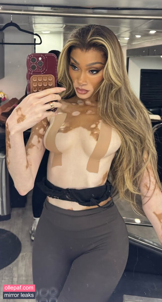 Latest Leaks Winnie Harlow Nude #41 - Fapello