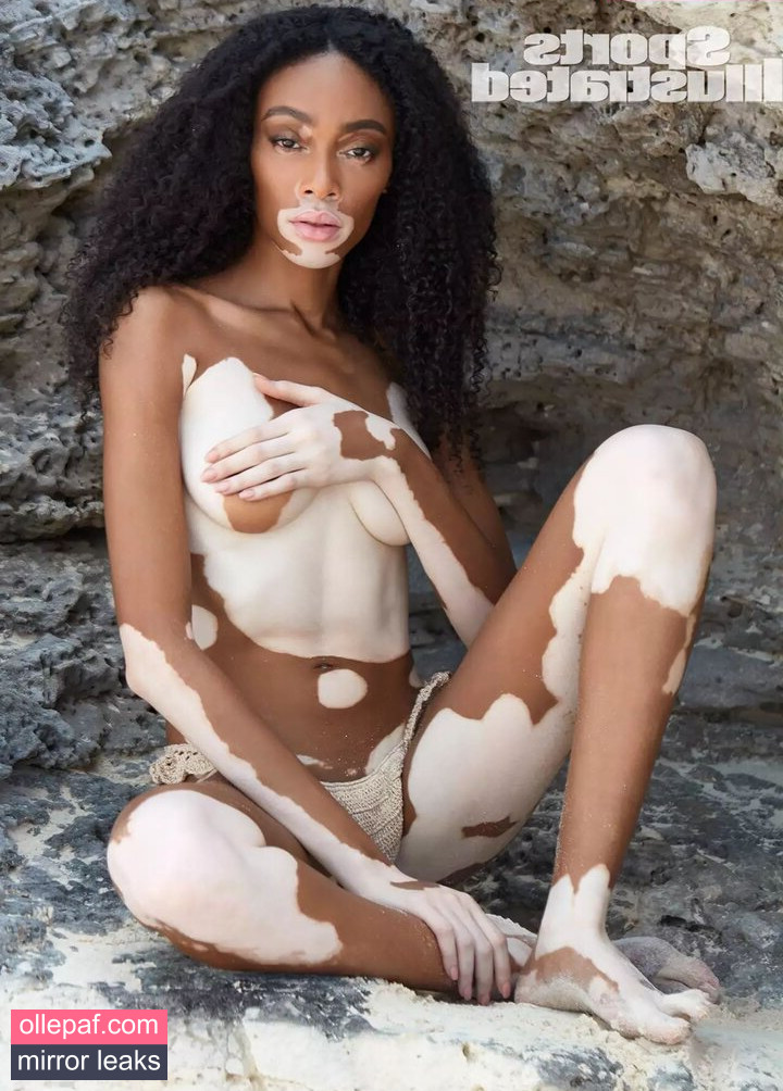 Latest Leaks Winnie Harlow Nude #406 - Fapello