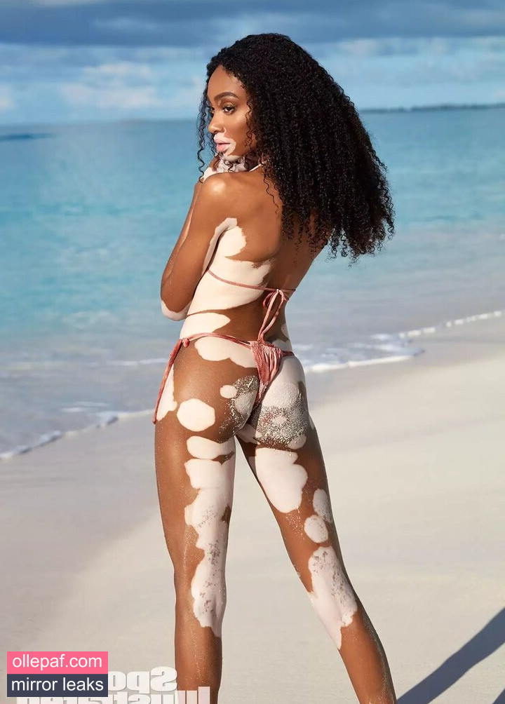 Latest Leaks Winnie Harlow Nude #407 - Fapello