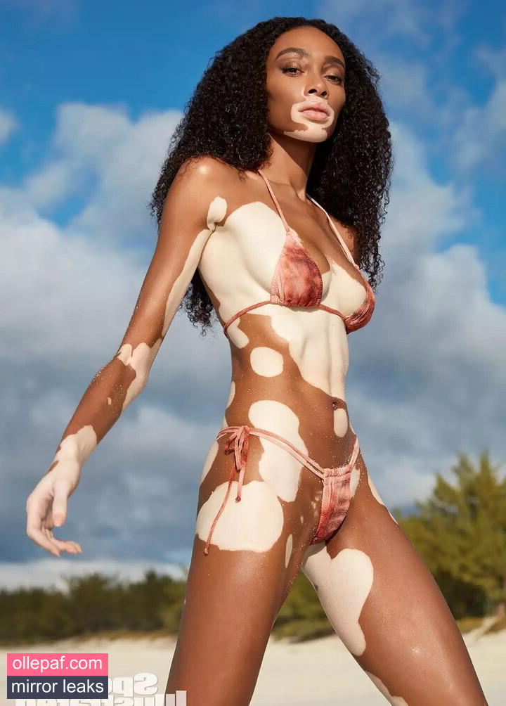 Latest Leaks Winnie Harlow Nude #410 - Fapello