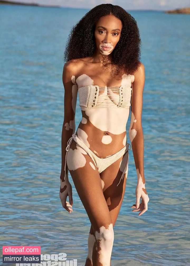 Latest Leaks Winnie Harlow Nude #411 - Fapello