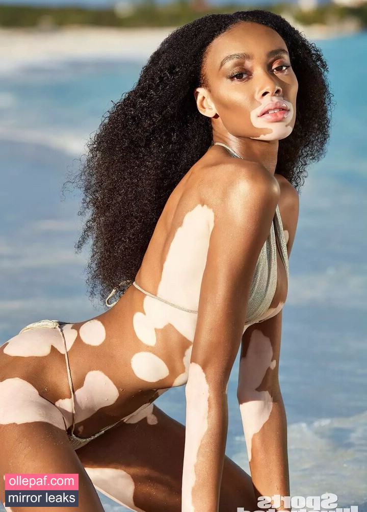 Latest Leaks Winnie Harlow Nude #415 - Fapello