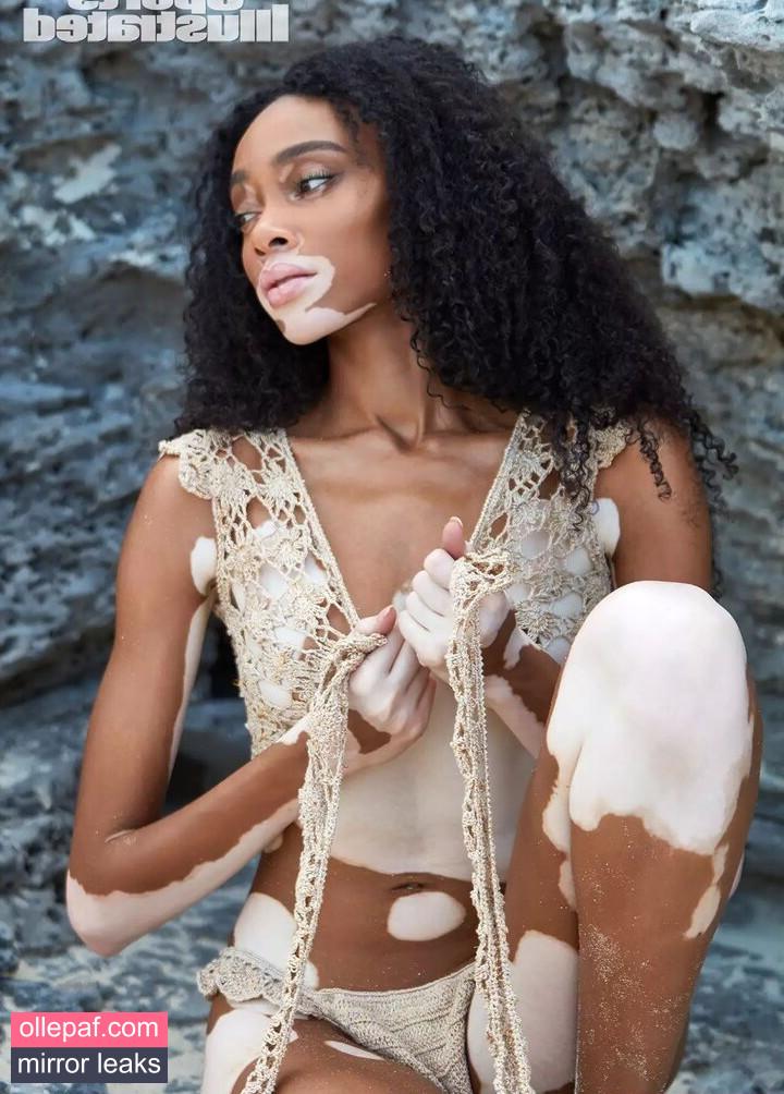 Latest Leaks Winnie Harlow Nude #418 - Fapello