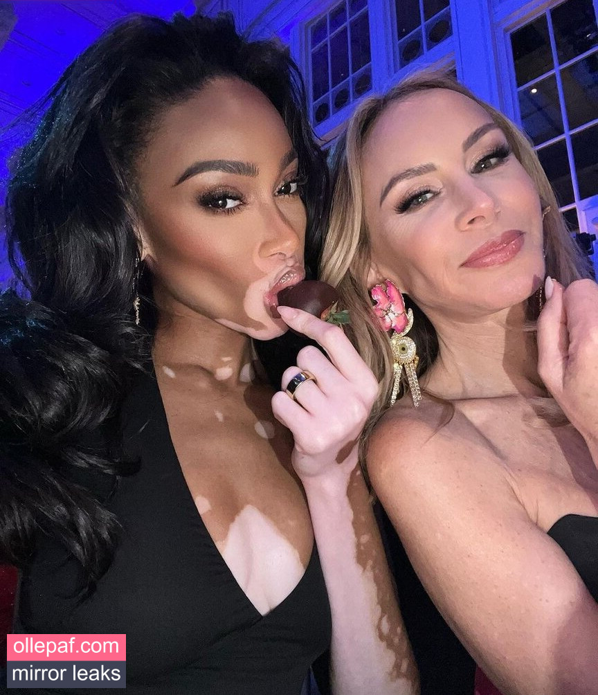 Latest Leaks Winnie Harlow Nude #433 - Fapello