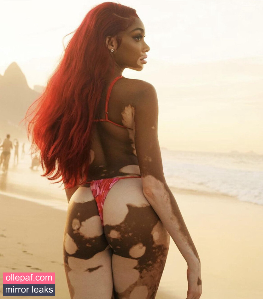 Latest Leaks Winnie Harlow Nude #437 - Fapello