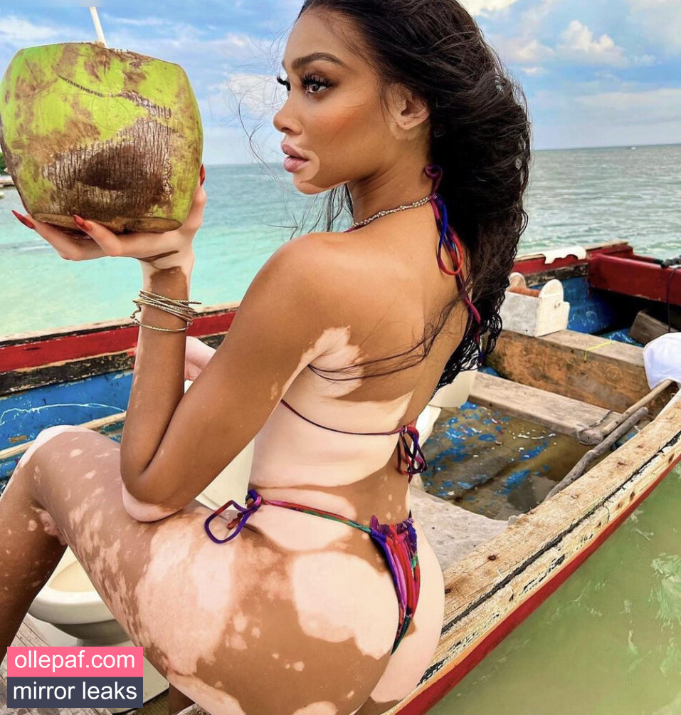 Latest Leaks Winnie Harlow Nude #441 - Fapello