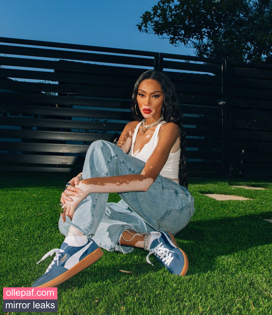 Latest Leaks Winnie Harlow Nude #450 - Fapello
