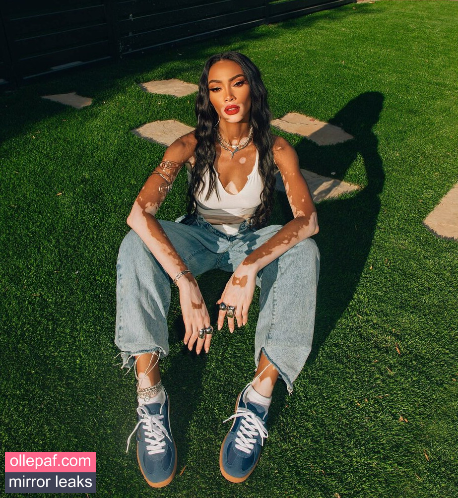 Latest Leaks Winnie Harlow Nude #451 - Fapello