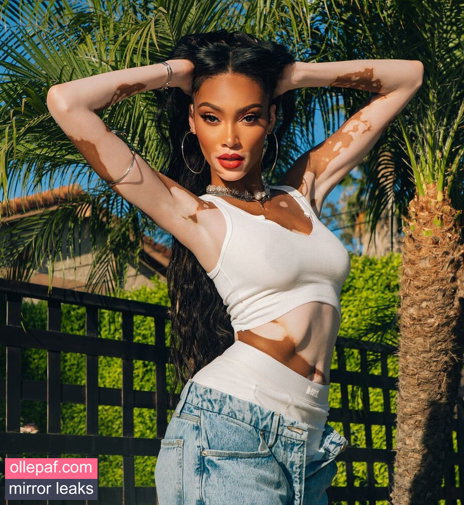 Latest Leaks Winnie Harlow Nude #452 - Fapello
