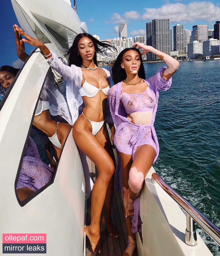 Latest Leaks Winnie Harlow Nude #454 - Fapello