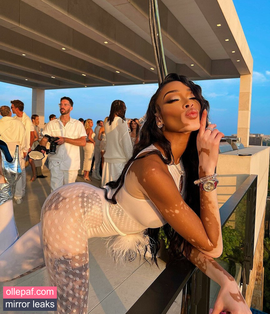 Latest Leaks Winnie Harlow Nude #458 - Fapello