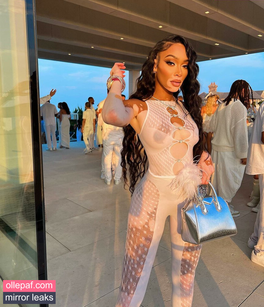 Latest Leaks Winnie Harlow Nude #461 - Fapello