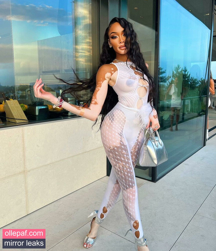 Latest Leaks Winnie Harlow Nude #462 - Fapello