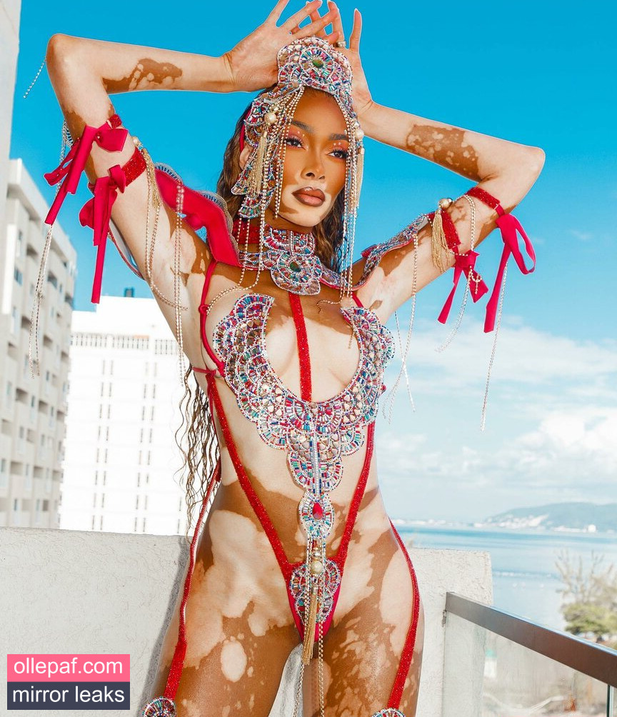 Latest Leaks Winnie Harlow Nude #469 - Fapello