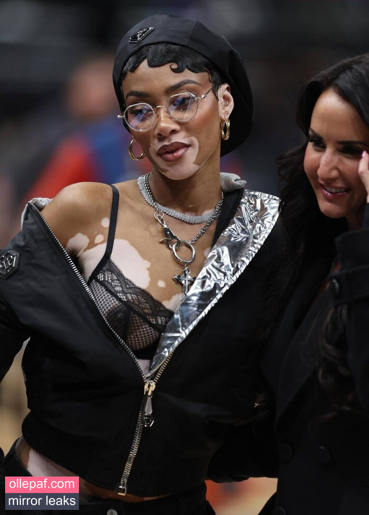 Latest Leaks Winnie Harlow Nude #49 - Fapello