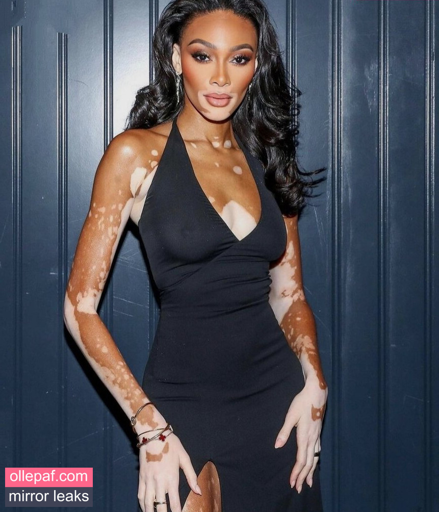 Latest Leaks Winnie Harlow Nude #516 - Fapello