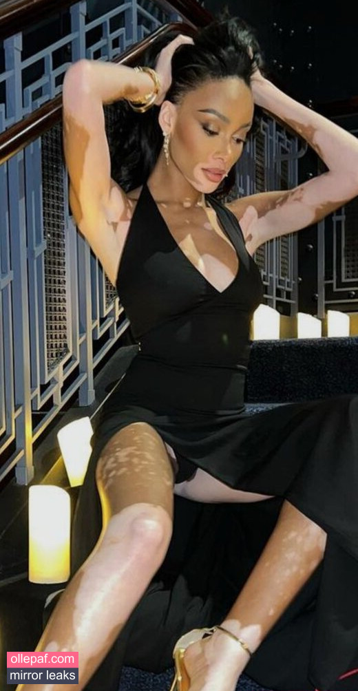 Latest Leaks Winnie Harlow Nude #518 - Fapello