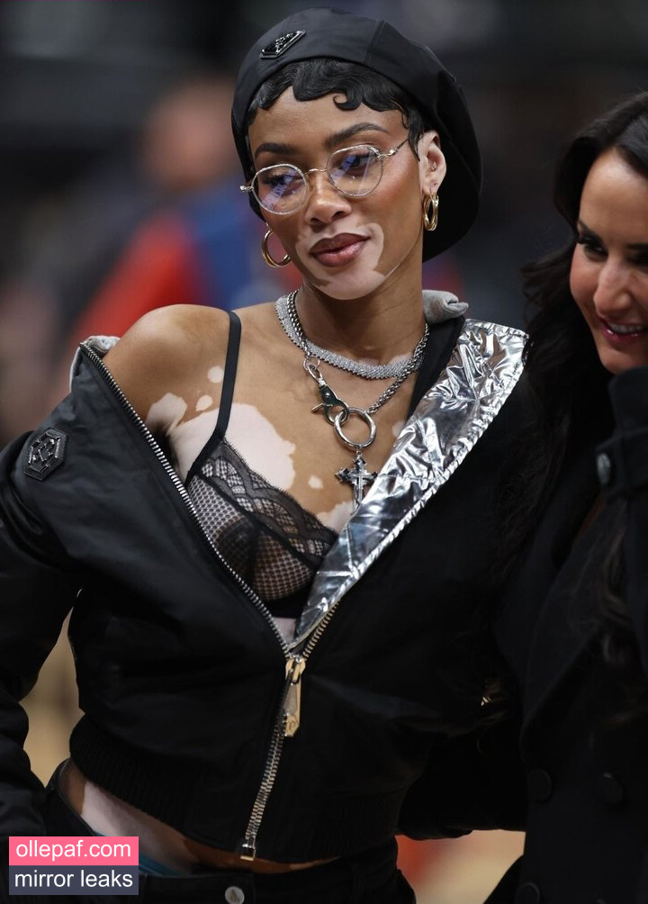 Latest Leaks Winnie Harlow Nude #53 - Fapello