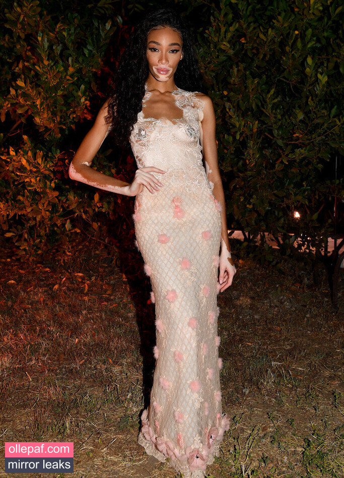 Latest Leaks Winnie Harlow Nude #91 - Fapello